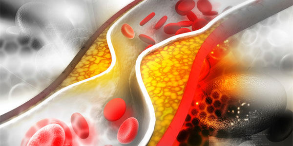 cholesterol in the body