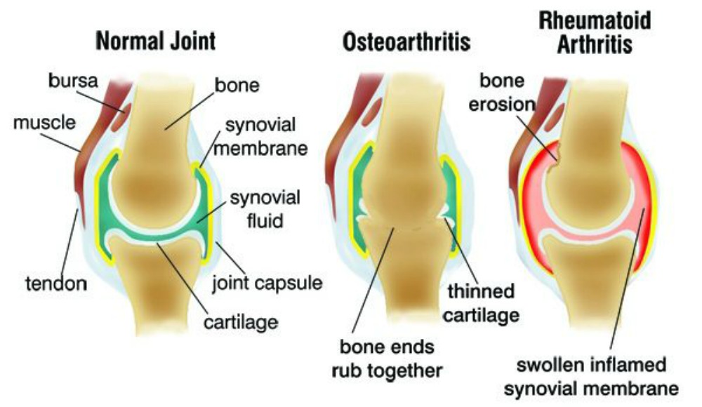 Joint