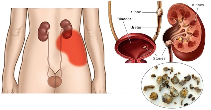 Kidneys