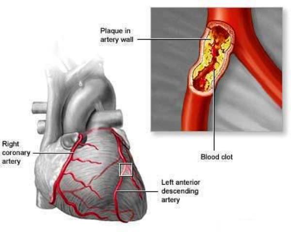 arteries