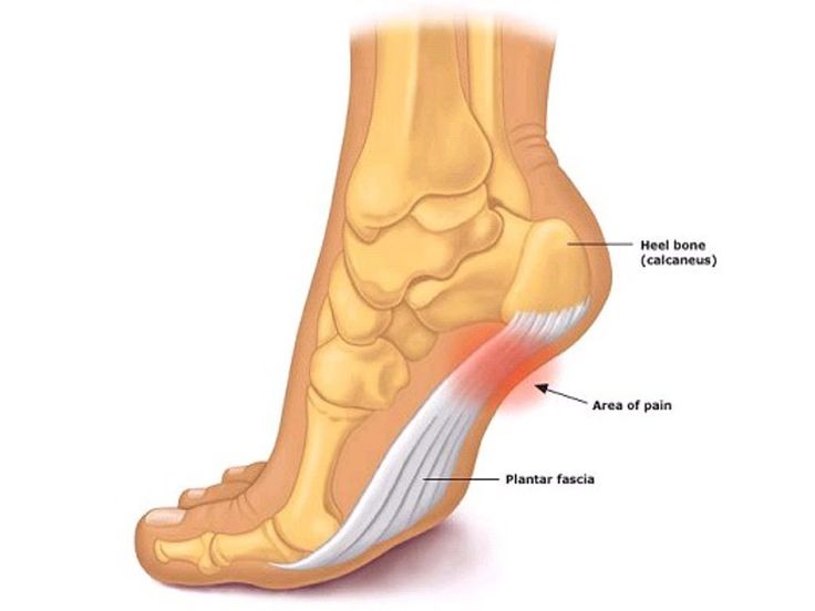 Plantar fascia