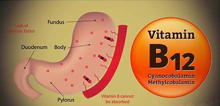 vitamin b12