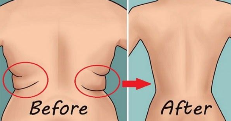 abdominal fat