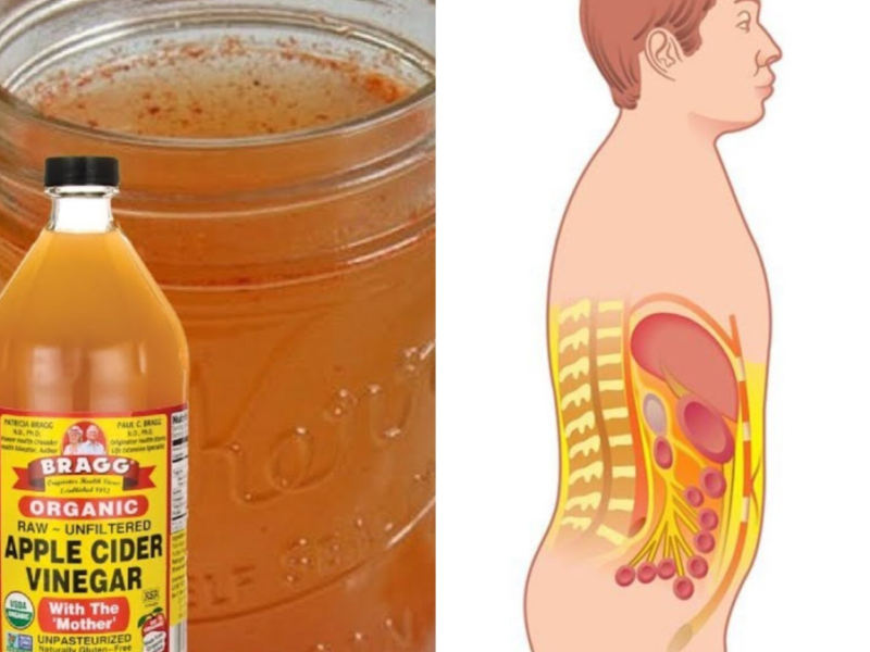 Apple cider vinegar