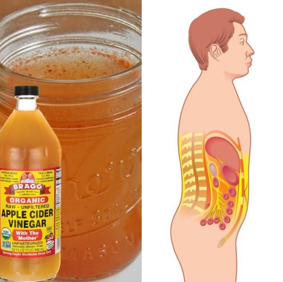 Apple cider vinegar