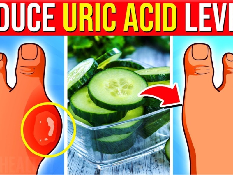 uric acid