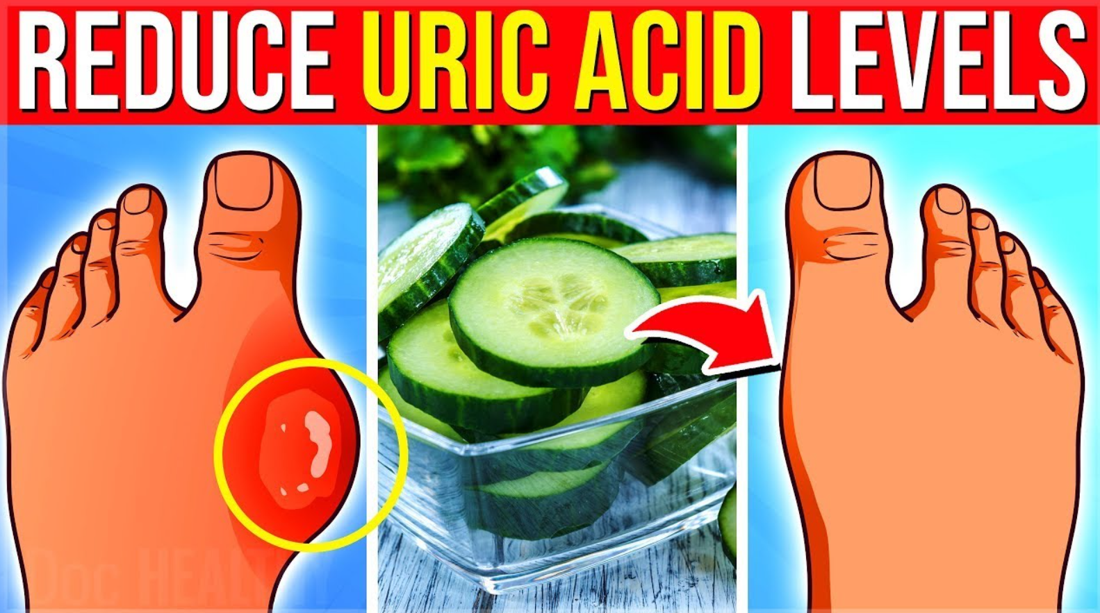 uric acid