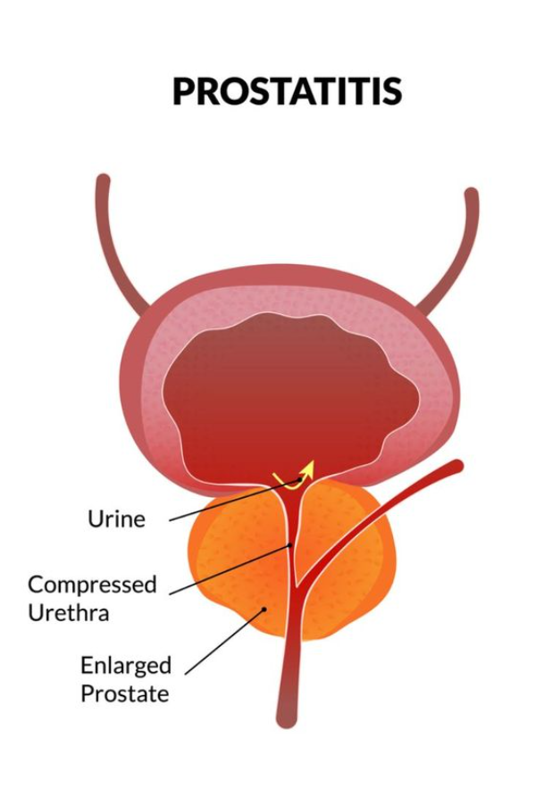 prostate health