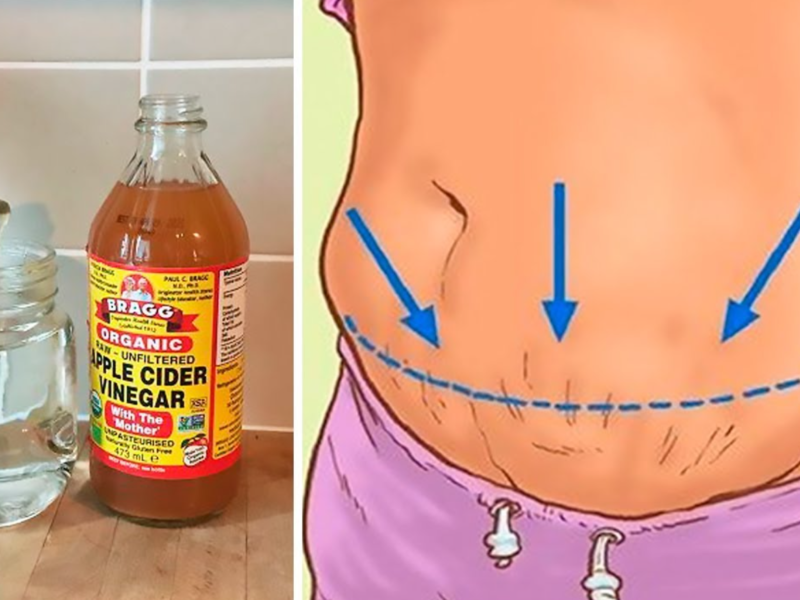 Apple cider vinegar