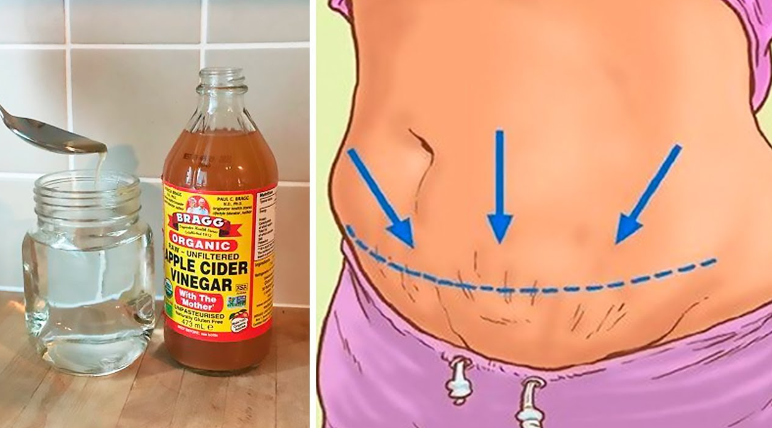 Apple cider vinegar