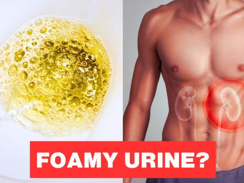 Foamy urine